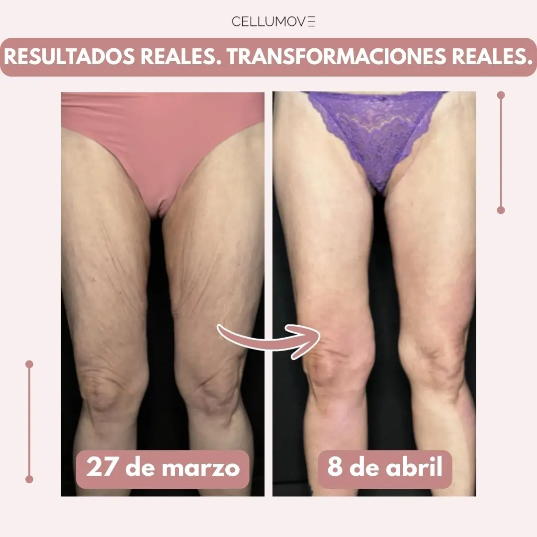 Imagen del producto 4